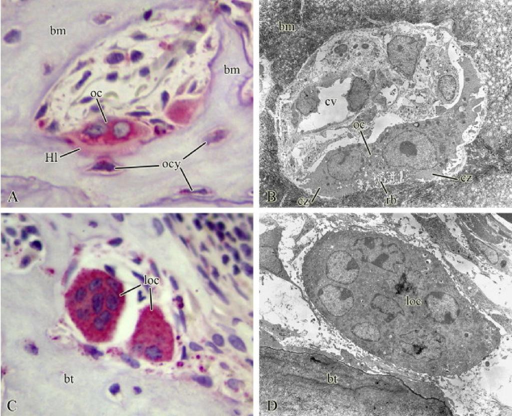 OSTEOCLAST SEJTEK: a csont alapállom llományát emésztik, a csontot lebontják k (tevékenys kenységüket ket a Howship-féle lacunák k jelzik) Oc, loc: