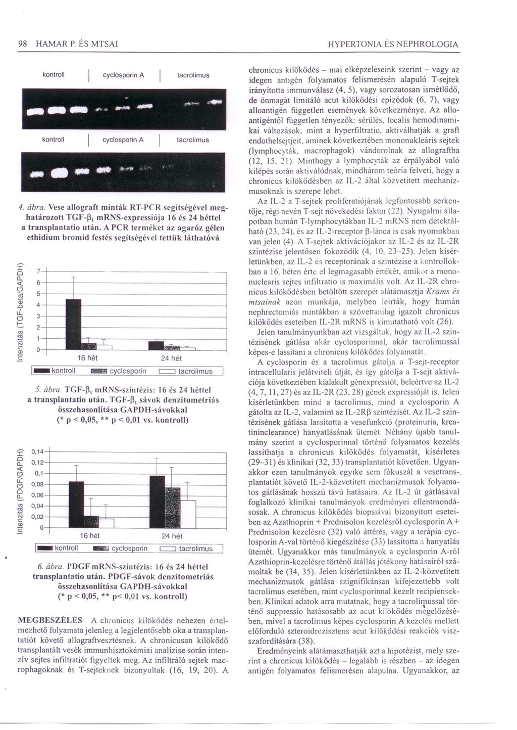 98 HAMAR P. ÉS MTSAI HYPERTONIA ÉS NEPHROLOGIA, kontroll cyclosporin A tacrolimus --- ".&.-..,,_~ l~ kontroll cyclosporin A tacrolimus b. 4. ábra.