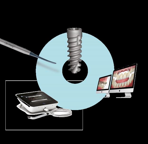 SOLUTIONS KURZUS IMPLANTÁCIÓS RENDSZER MEMBRÁN Bruttó 19.