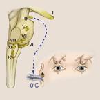 Vestibulo-ocularis reflex vizsgálata Jeges víz, vagy klóretil befecskendezése a külső hallójárat mélyébe