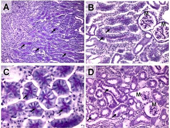 Lymphocyta vagy macrophag infiltratio, illetve PAS+ cylinderek egyik csoportban sem voltak megfigyelhetőek (grade mindkét csoportban: 0±0).