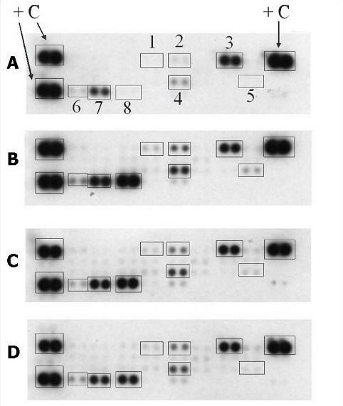 18. ábra PACAP hatása különböző citokinek expressziójára vese ischaemia/reperfúziót követően. A. Kontroll vese. B. 60 perc renalis ischaemia/reperfúzió hatása a citokin expresszióra. C.