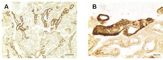 21. ábra Patkány vese szövettani képe PAC1 receptor immunfestéssel. A. Kis nagyítással: immunpozitív tubulusok a kéregállományban; B.