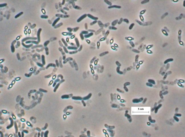 42. ábra Bacillus aurantiacus sejtek Gram festett fénymikroszkópos képe (Fotó: Borsodi A.) 55. GYAKORLAT A fénytörő ovális képletek érett endospórák. Méretvonal: 5 µm. Gram-festés Bacillus cereus var.