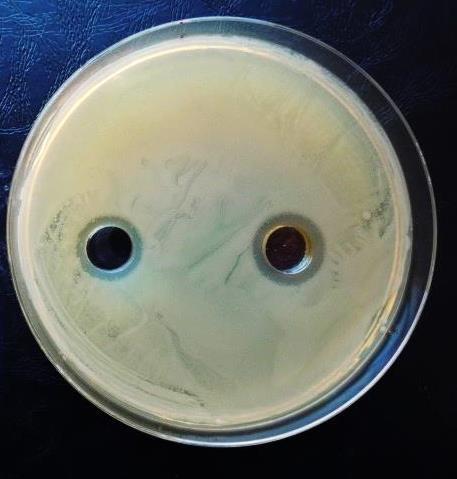 oltókacs kémcsőkeverő (vortex) húspepton tápagar lemez pipetta, steril pipettahegyek szélesztőbot (sterilezéshez alkohol) fémcsipesz antibiotikum korongok Bunsen-égő termosztát vonalzó 1.