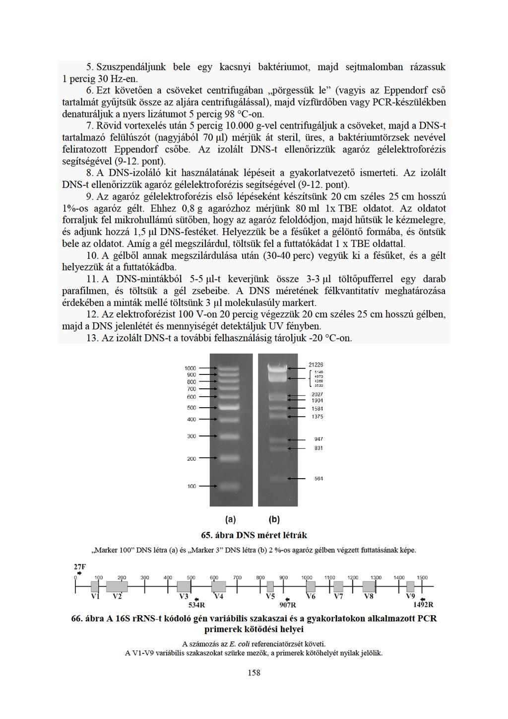 5.Szuszpendáljunk bele egy kacsnyi baktériumot, majd sejtmalombanrázasuk 1percig30Hz-en. 6.