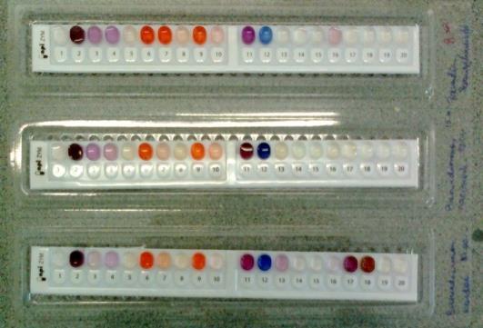 8 GYORSDIAGNOSZTIKAI ELJÁRÁSOK A mikrobiológiában használatos gyors identifikációs módszerek lehetővé teszik, hogy 24-48 óra alatt (esetenként ennél is gyorsabban) a baktériumok tiszta tenyészetének