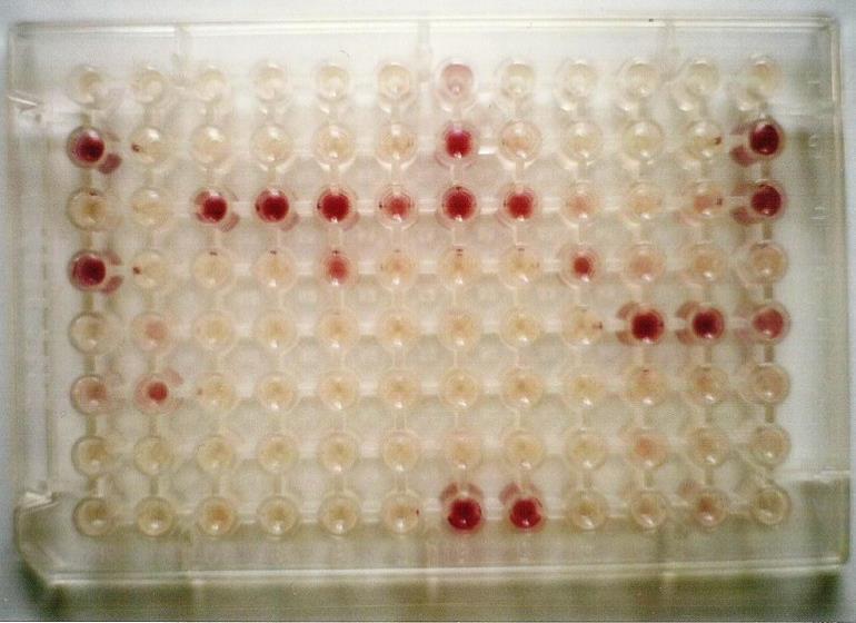 API tesztcsíkok és tárolók pipetta, steril pipettahegyek fiziológiás sóoldat szuszpenzió készítéséhez kémcsőkeverő (vortex) optikai denzitás mérésére szolgáló készülék (ELISA reader) Gram pozitív és
