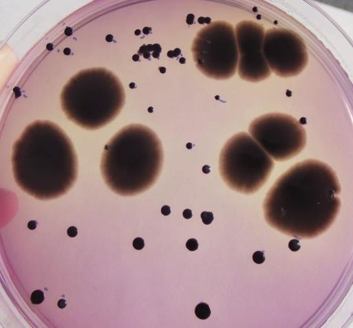 TTC (trifenil-tetrazolium-klorid) 5 ml 96%-os etanol 100 ml steril felolvasztott húspepton tápagar steril Petri-csészék Bunsen-égő termosztát 1.