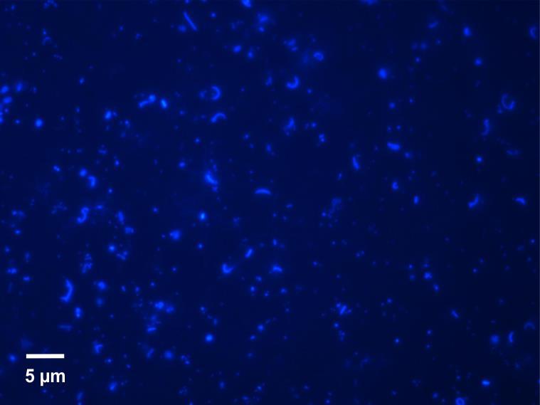 1. Készítsünk spóraszuszpenziót Aspergillus niger tenyészetéből. 2. Szorítsuk rá a kamrára a fedőlemezt. 3. A spóraszuszpenzióból egy cseppet helyezzünk a kamra fedőlemeze mellé.