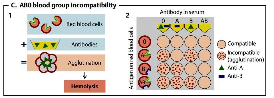 Antigén a VVT-n Az ABO vércsoport meghatározása AB0 inkompatibilitás Szérum antitest VVT Antitest Agglutinatio Kompatibilis Nem kompatibilis (agglutinatio) Keresztreakció: Major teszt: donor (adó)