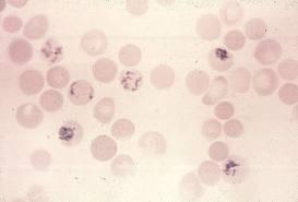 emberben mag, mitochondrium és endoplasmaticus reticulum nélküli, csak glikolízis -