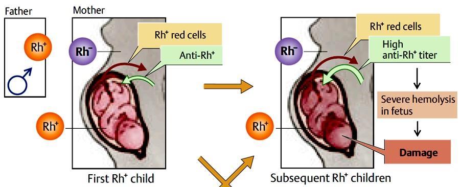Az Rh (Rhesus) vércsoport - Protein antigének, 3 allél: c/c, d/d, e/e - Egyedül a D produkál erős antigént Rh+ (85%) - Immunizáció automatikusan nem alakul ki csak ha: a. Rh- egyén Rh+ vért kap b.