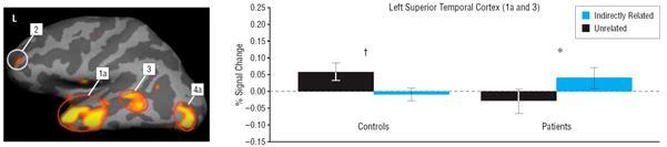 Kontrol Szkizofrénia Bal superior temporalis cortex (kiterjesztett Wernicke) Szemantikus kapcsolat