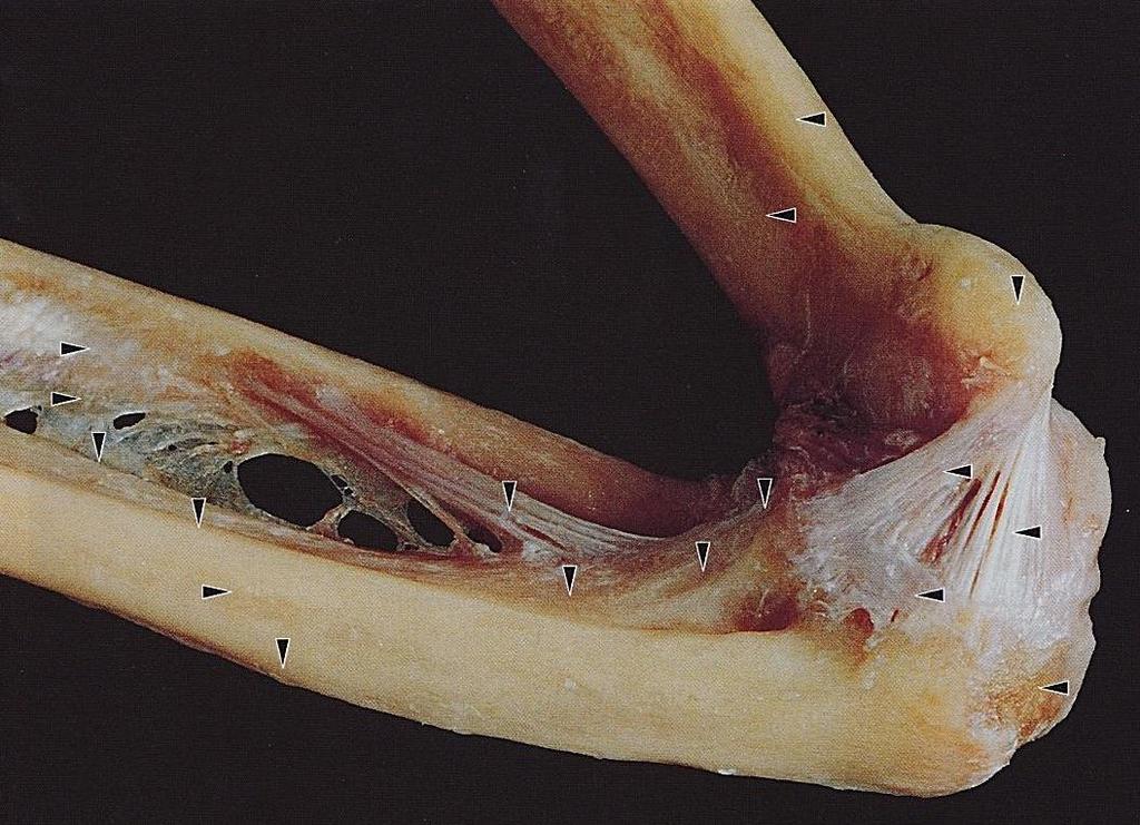 epicondylus medialis olecranon, processus
