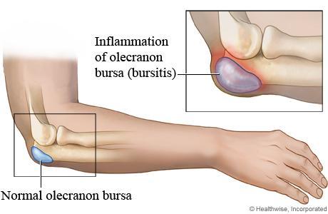 traumás sérülés, autoimmun betegség