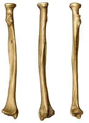 epiphysis proximalis incisura