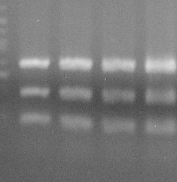 MET PCR-RFLP analízise. EcoRI enzimes emésztés..: a;.: b; 3.: c; 4.: d F; 5.