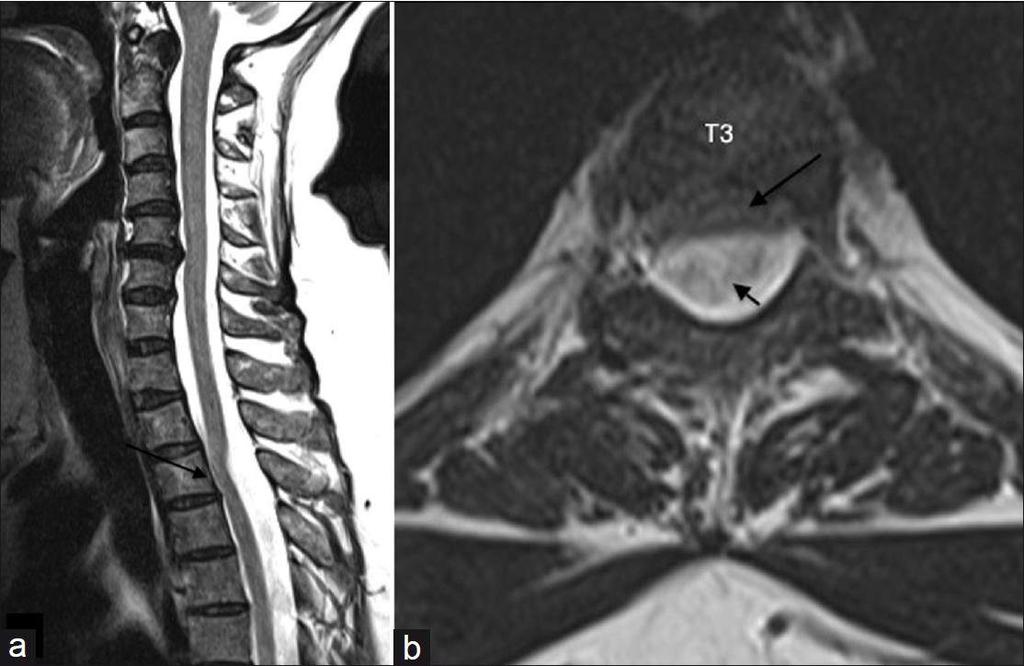 Anterior