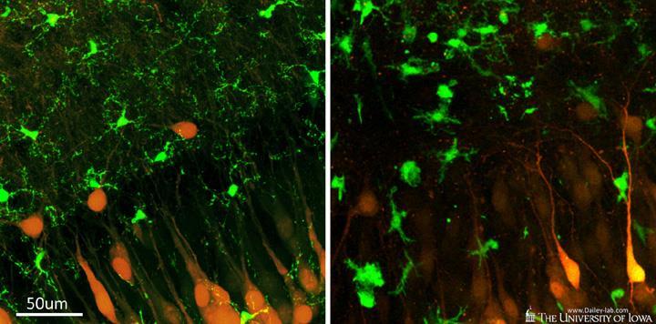Mikroglia aktiváció nyugvó resting aktivált (Bal)