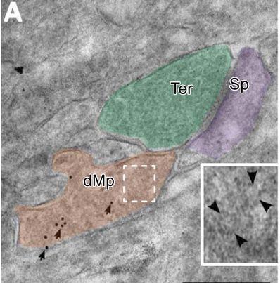 microglia marker Iba-1 (gold particles) Mikroglia szerepe az egészséges agyban: mikroglia-szinapszis kapcsolatok: 2 foton mikroszkópia: mikroglia átlagosan óránként