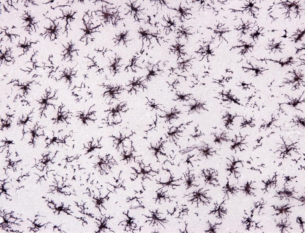 Mikroglia photo: Alexander