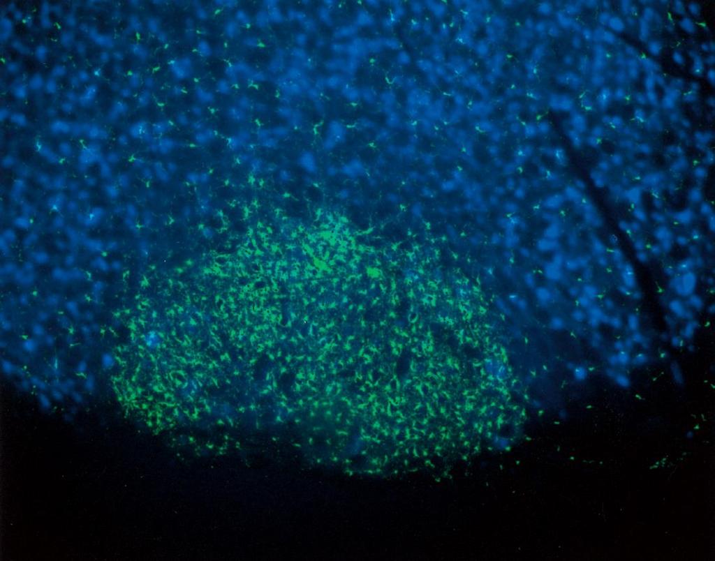 (facial nerve nuclei of axotomized CX3CR11/GFP mouse day 7 after