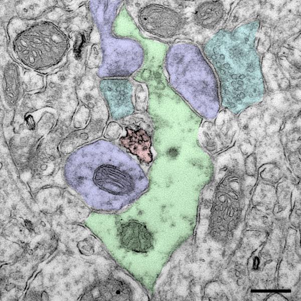 Mikroglia mikroglia retinában axon terminális dendrit és