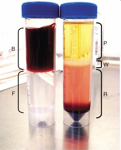 077g/ml) Ficoll- Paque (1.077 g/ml) (from Google pictures) (Nature Protocols h\p://www.nature.com/nprot/journal/v3/n6/images/nprot.