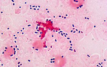 STREPTOCOCCUS PNEUMONIAE nem hivatalos, de elterjedt neve a pneumococcus nyálkahártya fertőzések (tüdőgyulladás);