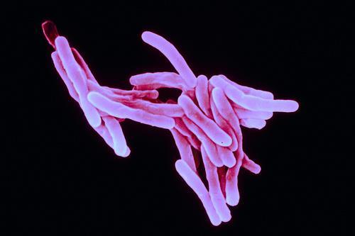 MYCOBACTERIUM TUBERCULOSIS Pálcák, melyek