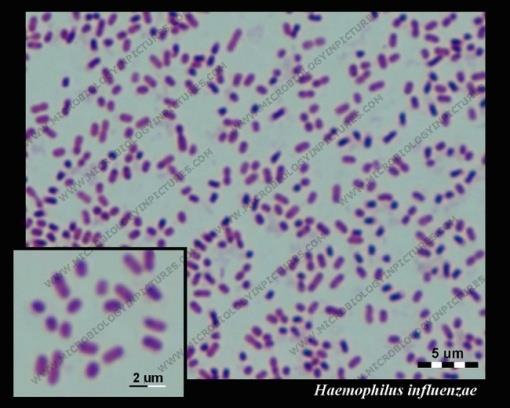 HAEMOPHILUS Ezek a baktériumok kis, Gram-negatív pálcák,