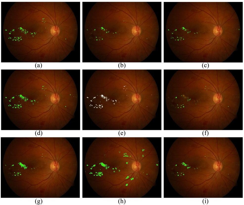 For the sake of completeness, Figure 32 demonstrates the differences between the results of the proposed algorithm and the state-of-the-art methods involved in our comparative study.