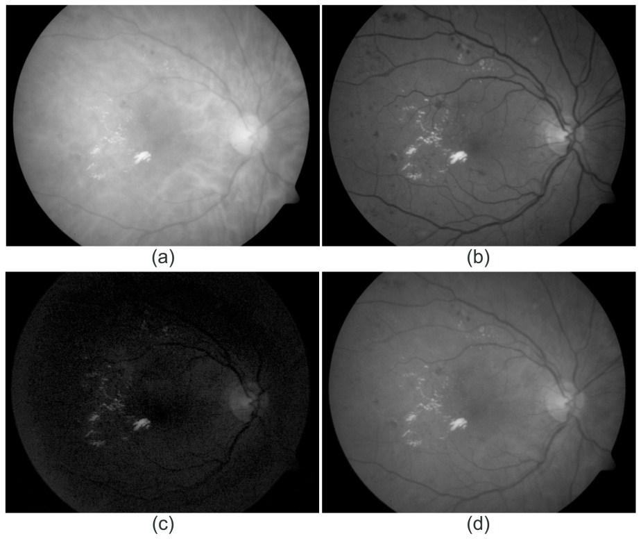 image. So, is the most common output of the fundus camera generally in use.