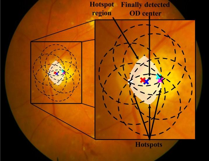 Single and Multiple Object Detection Problems in Medical Image Analyses ...