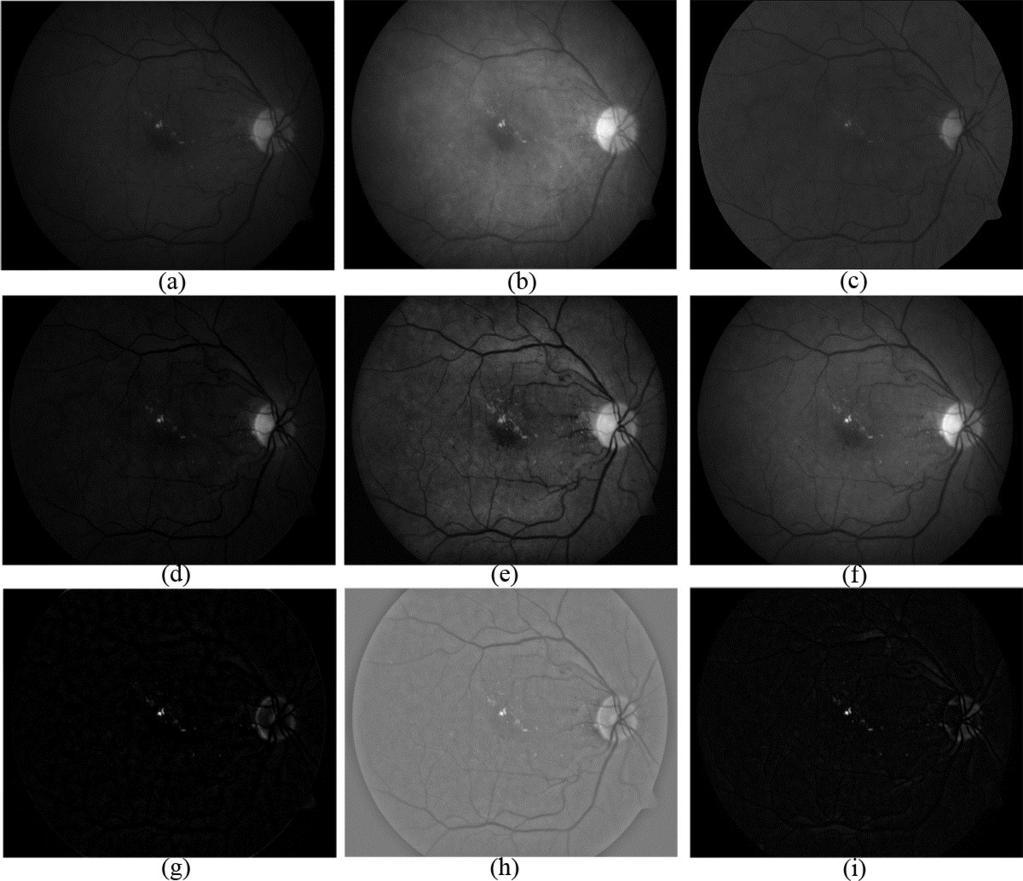 Figure 26: Nine different variants of the input image. (a), (b), (c), (d), (e), (f), (g), (h), (i). 4.3.