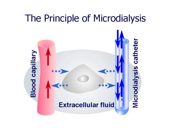 Microdialysis 0.