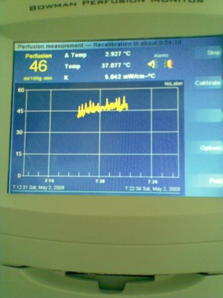 termisztor 2-2.5 C-al az alap hőmérséklet (prox.
