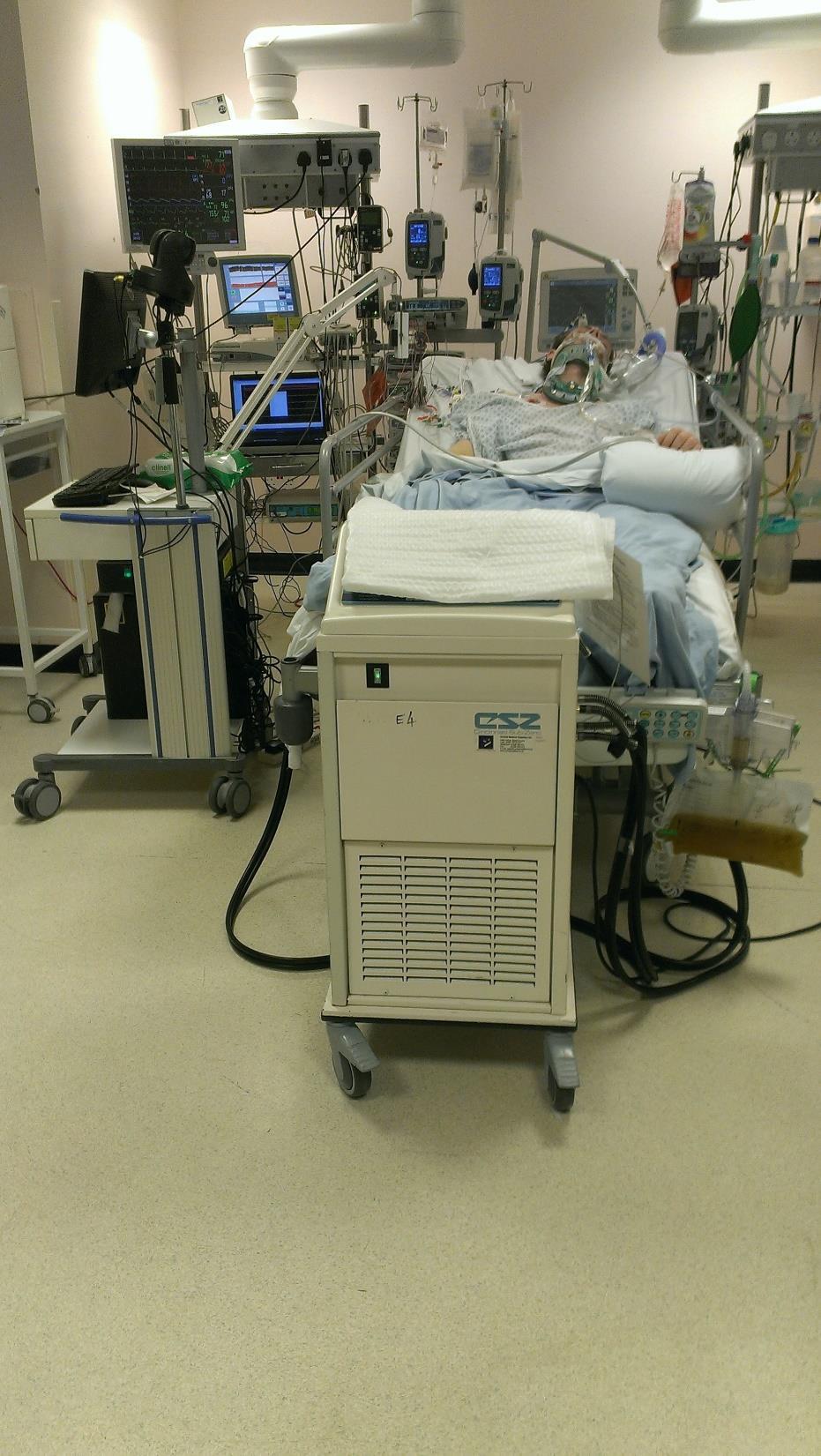 ICP mérés CPP (agyszöveti perfúziós nyomás) PRx (pressure reactivity index) PbrO2 (agyszöveti O2 tenzió) SjvO2 (jugularis