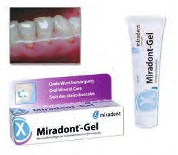 Bevezető készlet: 022 0 x 1 ml gél, x 250 ml szájöblítő, applikációs kanül 1 csomag 9.995 022 1 gél, x 1 ml 1 csomag 7.995 022 2 szájöblítő, 250 ml 1 flakon.