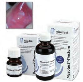 495 Coe-Pak (GC) Eugenolmentes parodontális sebpakolás. 047 00 normál csomag: 90 g bázis, 90 g katalizátor 1 csomag 16.
