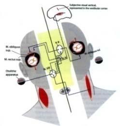 Aetiopathiomechanizmus KNYF - liquor keringési zavarok - hydrocephalus - Hypersecretios hydrocephalus fokozott liquor termelődés
