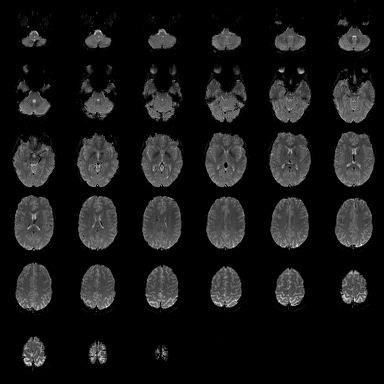 lokalitását és időbeli változását vizsgálja Az fmri elsődleges célja a neurális változással