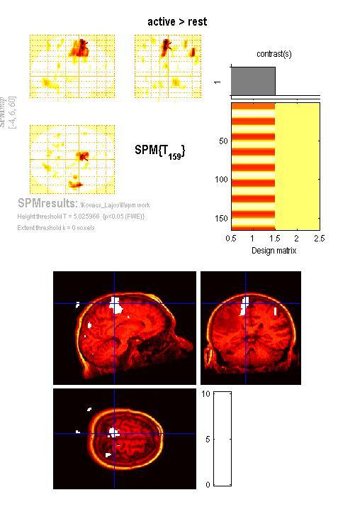 Bajzik Gábor (képi diagnosztika) - Tóth Lilla (fmri