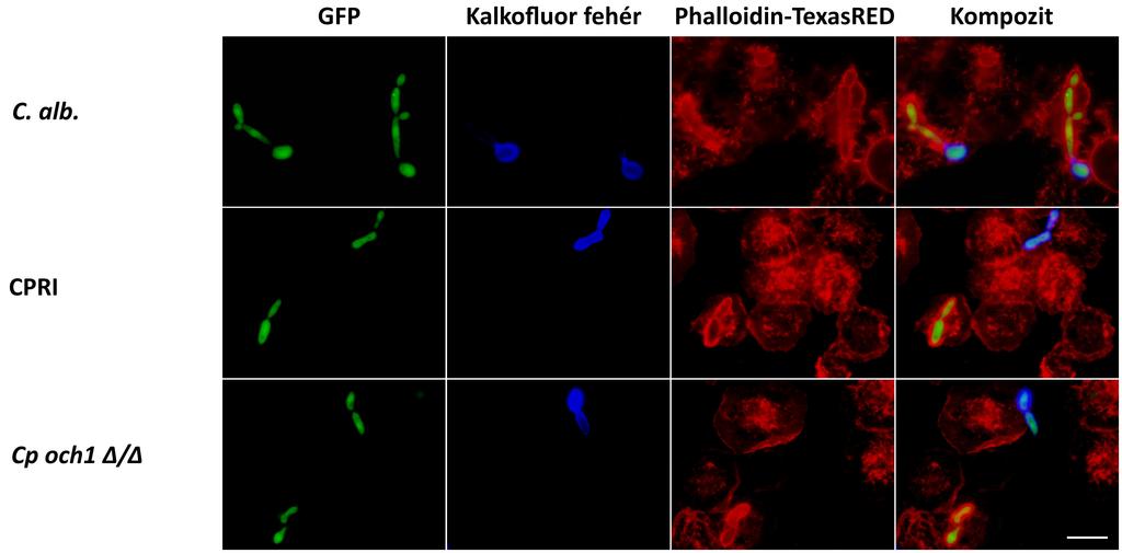 12. ábra. Az l(3)mbn-1 Drosophila lárvából izolált hemociták fagocitózisának vizsgálata. Inkubációs idő 3 óra.