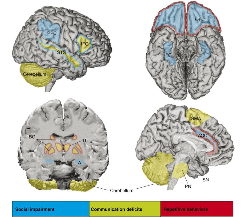 Az autizmus anatómiájának összefoglalása OFC orbitofrontalis cortex FG fusiform gyrus PPC posterior parietalis cortex A - amygdala AC anterior cingulum IFG inferior