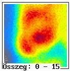 : 450515 Beküldô int.: Szigetvár Bel. Diagnosis: St.p.inf.myoc.