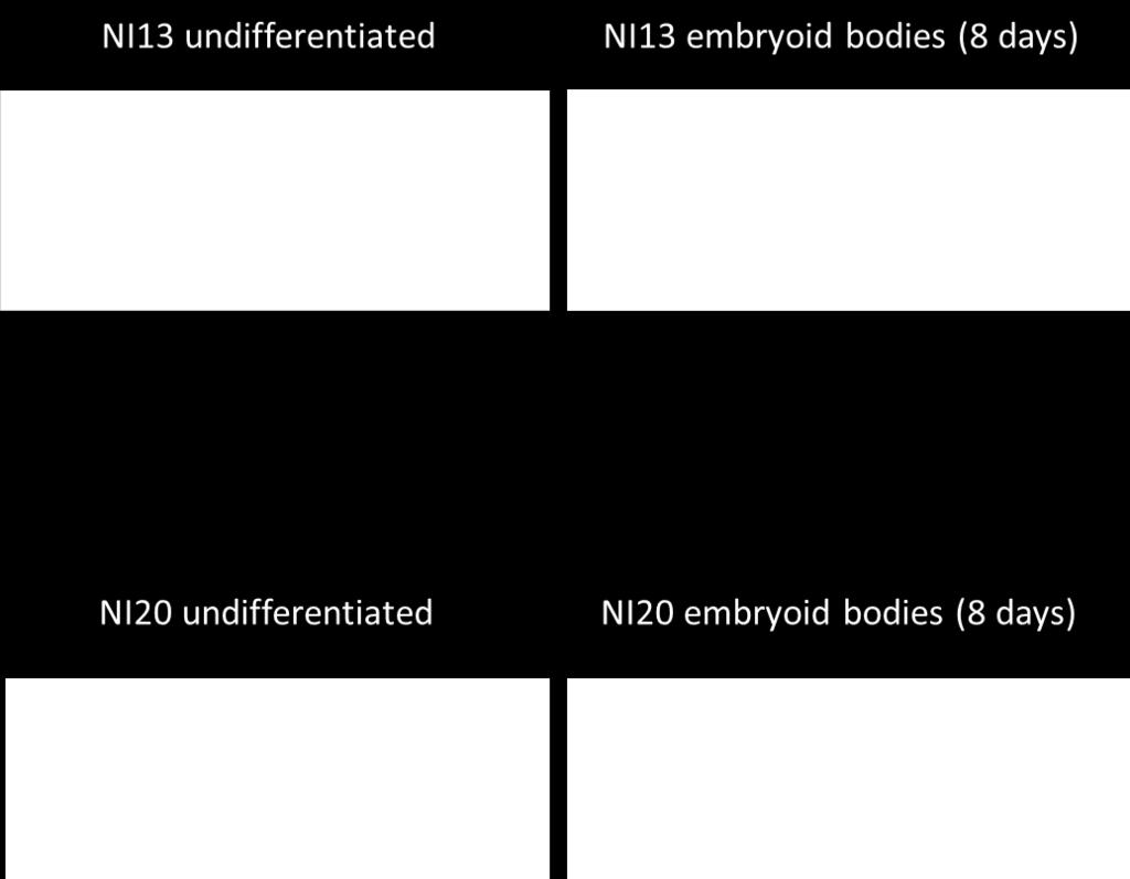 T-PC amplification fo exogenous reprogramming factors was performed on total NA extracted from NI13 and NI20