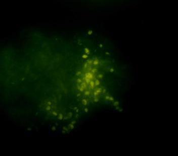 A B C 20. ábra Aspergillus nidulans FGSC 26 törzs protoplasztok Annexin V (A) és TUNEL (B, C) festést követıen.