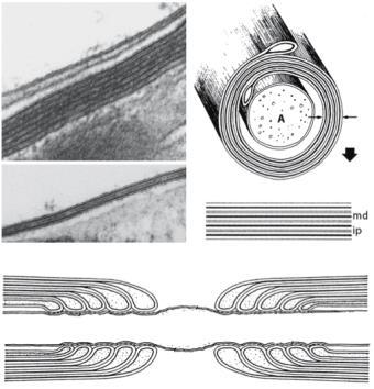 thalamusban és globus pallidusban Valk-van der Knaap: Magnetic resonance imaging of white matter diseases,